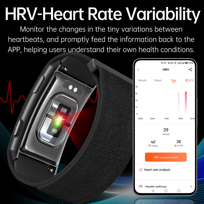 VWAR Loop X ECG Smart Bracelet - Xbody Health & Wellness Functional Integrative Medicine Office & Medical Spa Reviews 리뷰 및 가격